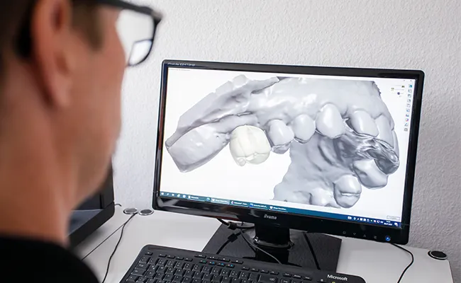 Digitale Zahntechnik mit 3D-Modell eines Gebisses auf dem Computerbildschirm im Dentallabor